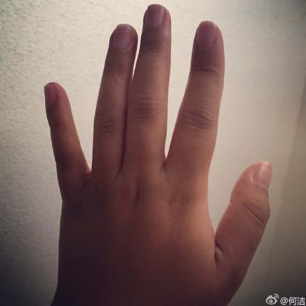  何洁 晒手部 水肿 照 叹二胎怀孕辛苦--深圳频道-